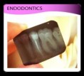 /album/endodontics/endodontics-6-jpg/